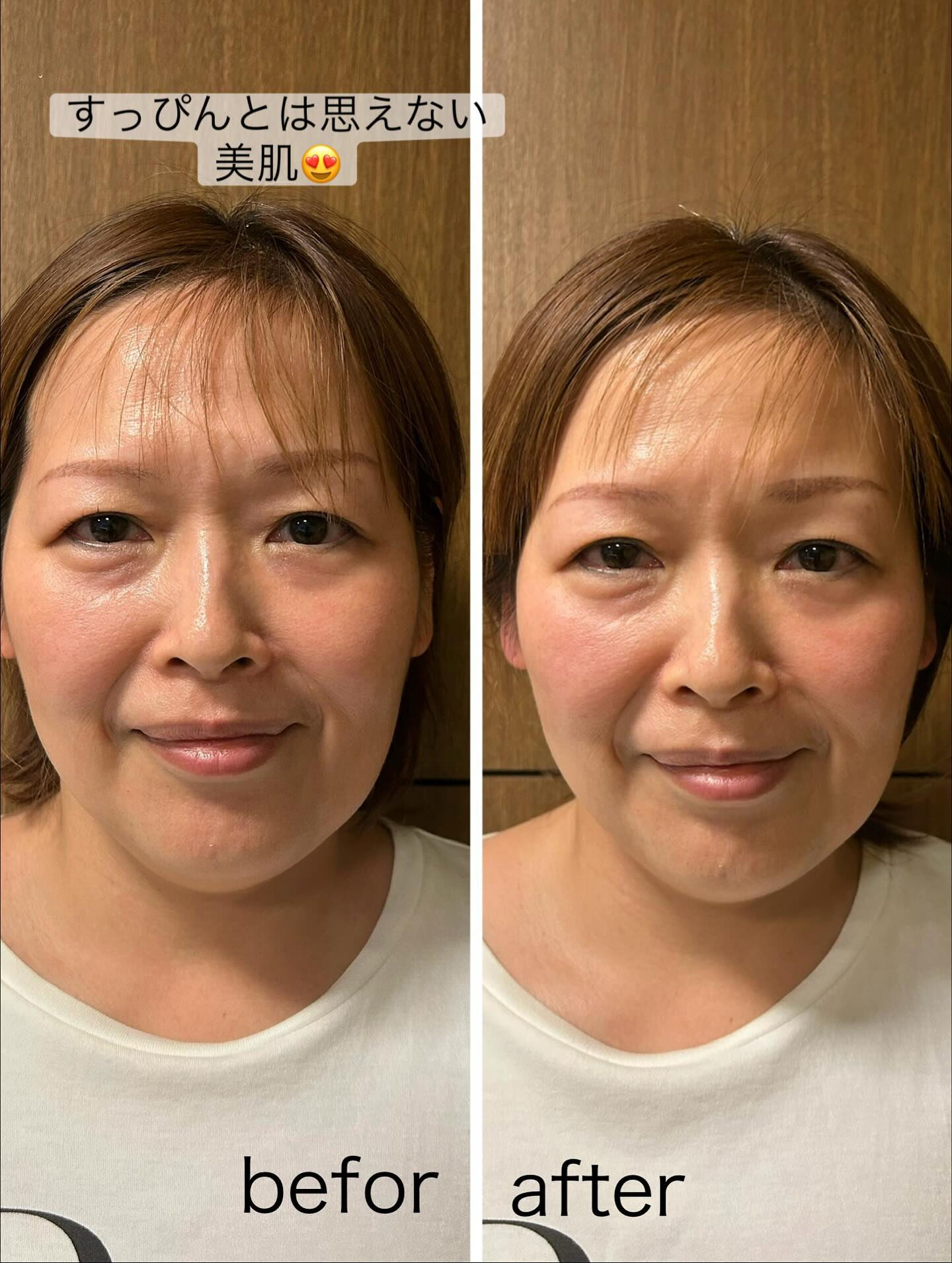 【頭と身体遮断されていない！？】